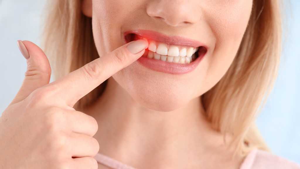 periodontal gum disease west kelowna dentist