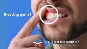 gum-disease-kelowna-dentist