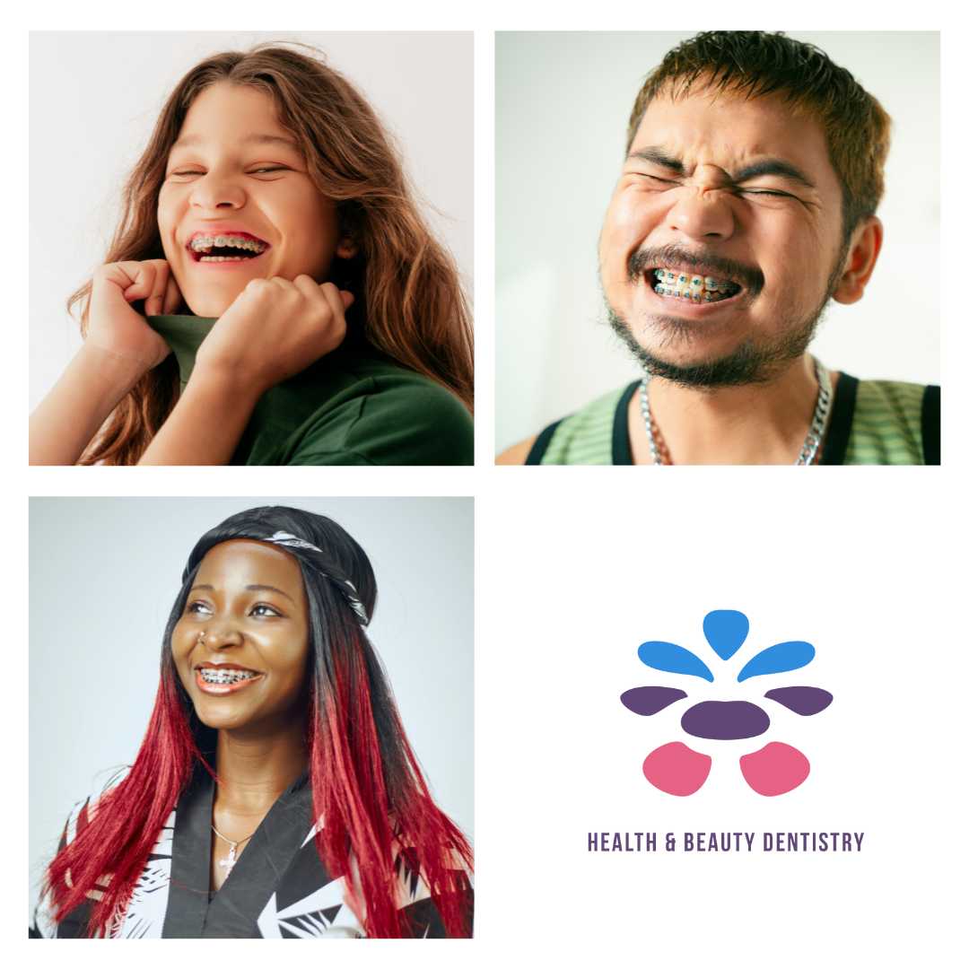 braces-dentistry-dentist-palmer-kelowna-bc